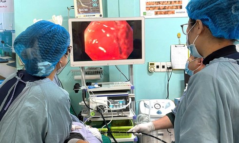 Hơn 100 polyp phủ kín dạ dày người phụ nữ