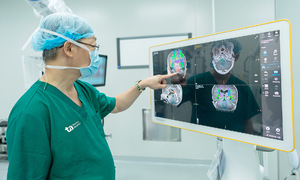 Dùng AI mổ u não bé trai