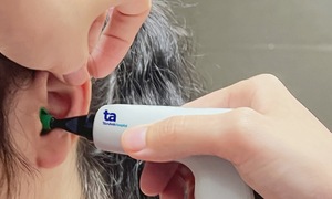 Vì sao nên sàng lọc nghe kém trẻ sơ sinh?
