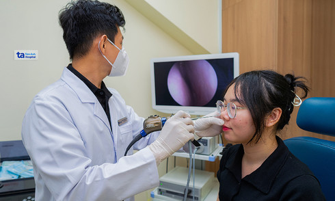 Viêm xoang có gây polyp mũi không?