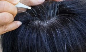 Tóc bạc sớm có phải do yếu sinh lý?