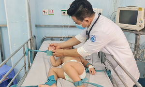 Trẻ mắc tay chân miệng tại TP HCM tăng