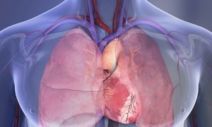 Phát hiện nhồi máu cơ tim sau 2 ngày đau ngực