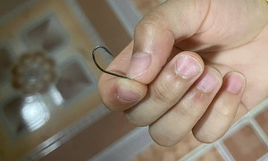 Lưỡi câu 5 cm móc vào gáy bé trai