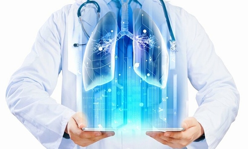 AI giúp bác sĩ phát hiện ung thư phổi sớm 4 tháng