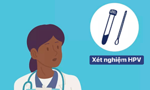 Triệu chứng nhiễm HPV ở lưỡi