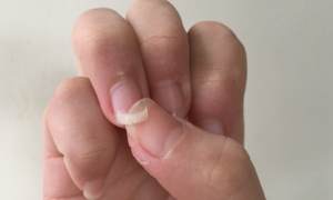 Dấu hiệu cảnh báo rối loạn nội tiết tố