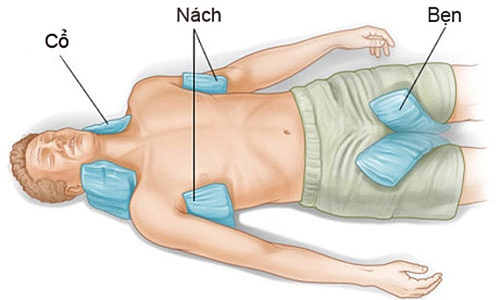 Nguy cơ rối loạn thần kinh, suy đa tạng bởi say nắng