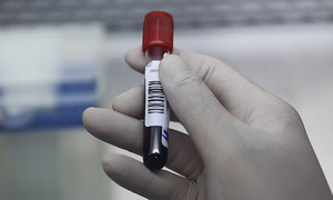 Hơn 44% người Việt trưởng thành có cholesterol máu cao