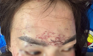 Công an Cà Mau khởi tố vụ người phụ nữ bị đánh, xăm lên mặt