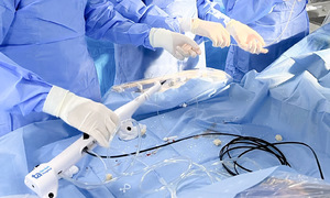 Dùng mũi khoan kim cương xuyên thủng mảng xơ vữa vôi hóa