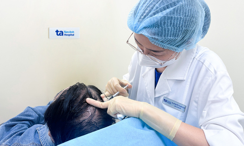 Tiêm meso chữa rụng tóc