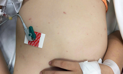 Ca não mô cầu tăng ở miền Nam cảnh báo dịch