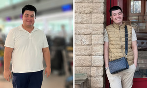 Giảm 60 kg sau phẫu thuật thu nhỏ dạ dày