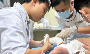 Dị tật bàn chân khoèo ở trẻ em