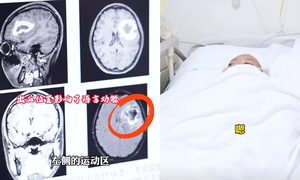Đột ngột mất khả năng nói tiếng Anh