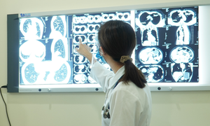 Bị xẹp phổi có chữa khỏi không?