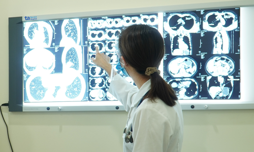Bị xẹp phổi có chữa khỏi không?