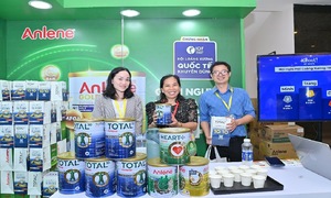 Loãng xương và thoái hóa khớp - 'kẻ thù' của sức khỏe vận động