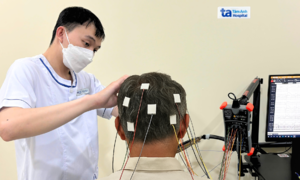 Dấu hiệu sa sút trí tuệ thể Lewy
