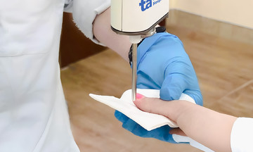 Bắn laser trị u cuộn mạch móng không cần phẫu thuật