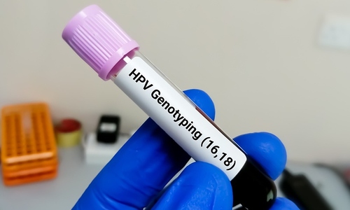 Những hiểu lầm nguy hiểm về HPV