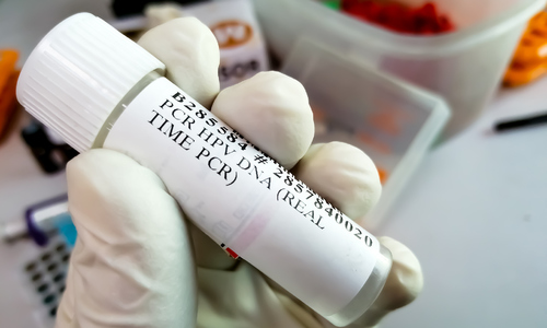 HPV phổ biến như thế nào?