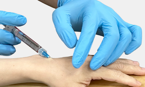 Tiêm filler làm đầy bàn tay được không?