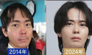 Nam giới Nhật mạnh tay chi tiền trẻ hóa