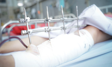 Người phụ nữ đa chấn thương do tường sập đè ở Long An
