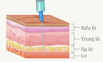Tiêm botox hiệu quả bao lâu?