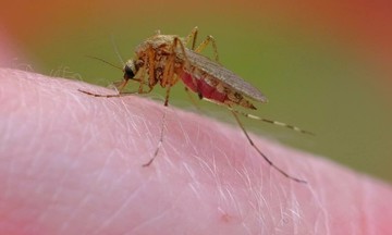 Những di chứng của viêm não Nhật Bản ở trẻ em