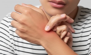 6 dấu hiệu ban đầu cảnh báo bệnh thận