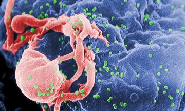 Tìm ra cách tiềm năng chữa khỏi HIV vĩnh viễn