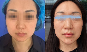 Người vợ hối hận vì giấu chồng vay tiền đi làm đẹp