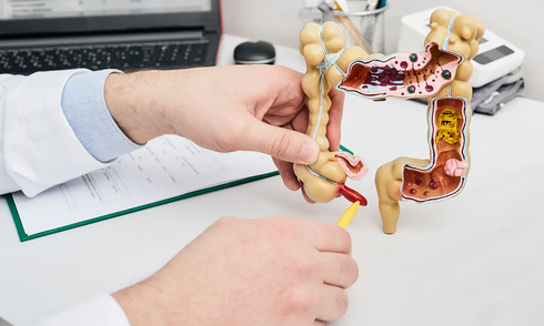 Loại ung thư ít gặp ngày càng tăng ở người dưới 50 tuổi