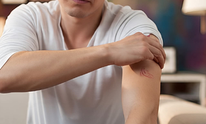 4 thay đổi trên da cảnh báo bệnh gan