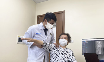 Thay khớp đảo ngược bởi xương vai gãy nát