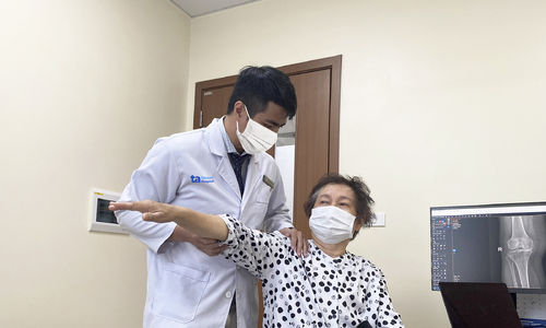 Thay khớp đảo ngược bởi xương vai gãy nát