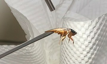 Gắp con gián còn sống khỏi tai người phụ nữ