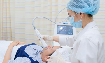 Trị mụn trứng cá bằng vi kim RF được không?