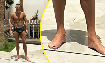 Giải mật thể thao: Móng chân sơn đen của Ronaldo