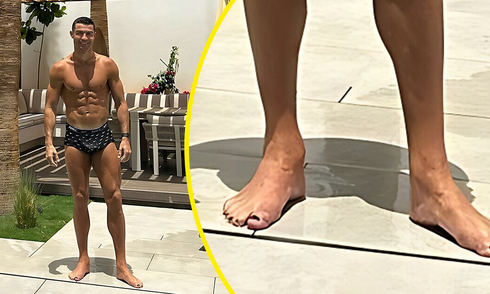 Giải mật thể thao: Móng chân sơn đen của Ronaldo