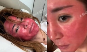 Cô gái 22 năm không tẩy trang