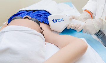 Công nghệ IPL có triệt lông nách vĩnh viễn không?