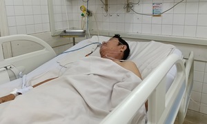 Viêm não do zona thần kinh khó nhận biết