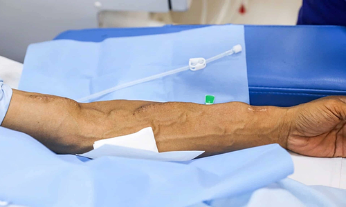 Suy thận tuổi đôi mươi do dùng thuốc bừa bãi