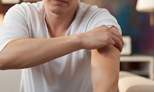 5 dấu hiệu thiếu vitamin D trên da, bàn chân