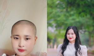Cú sốc của những người trẻ mắc ung thư