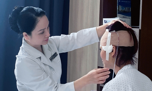 Mặt biến dạng sau 8 năm tiêm filler